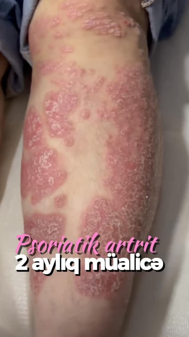 Post 9 by Nərgiz Hüseynova on Instagram (video)