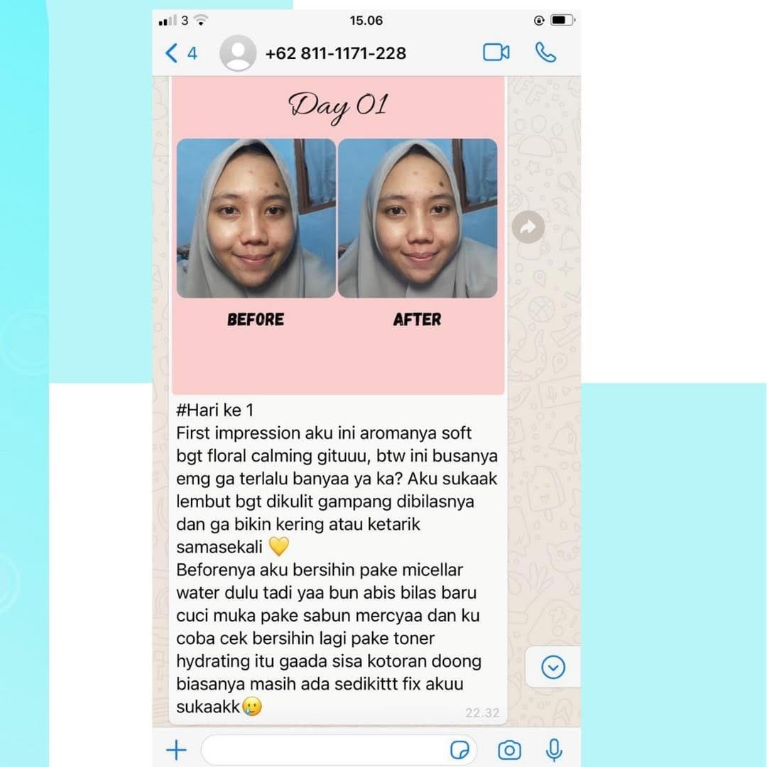 Post 9 by RUMAHMASKER MS GLOW JOGJA on Instagram (image)