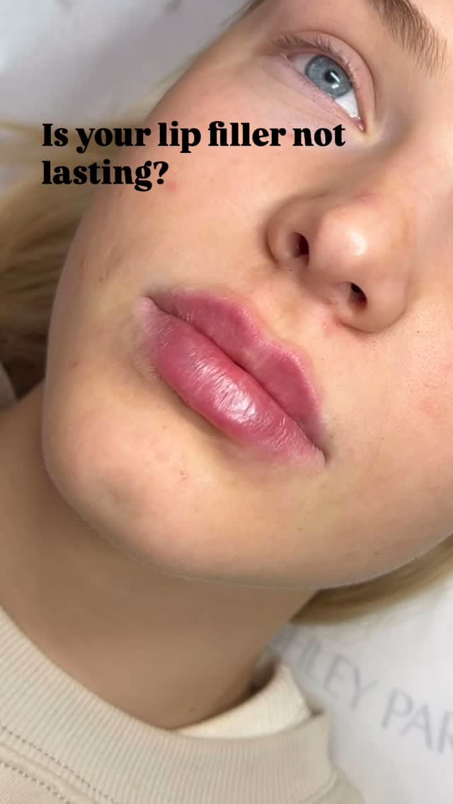 Post 2 by LIP FILLER | NATURAL ENHANCEMENTS | BRIGHTON on Instagram (video)