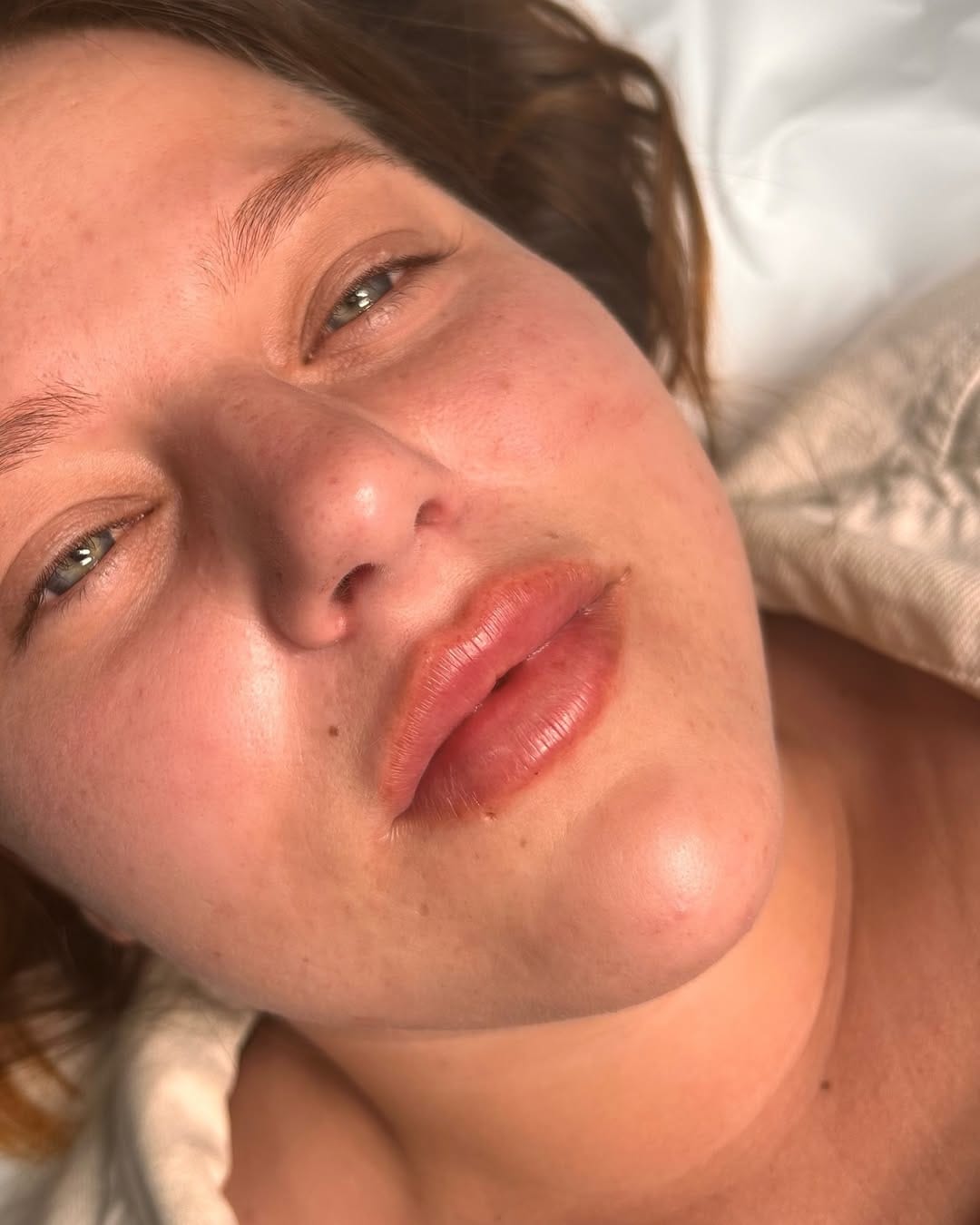 Post 6 by LIP FILLER | NATURAL ENHANCEMENTS | BRIGHTON on Instagram (image)