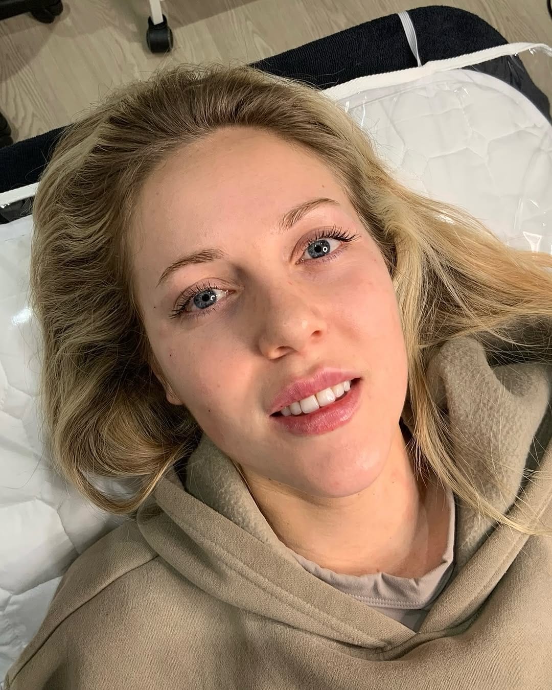 Post 7 by LIP FILLER | NATURAL ENHANCEMENTS | BRIGHTON on Instagram (image)