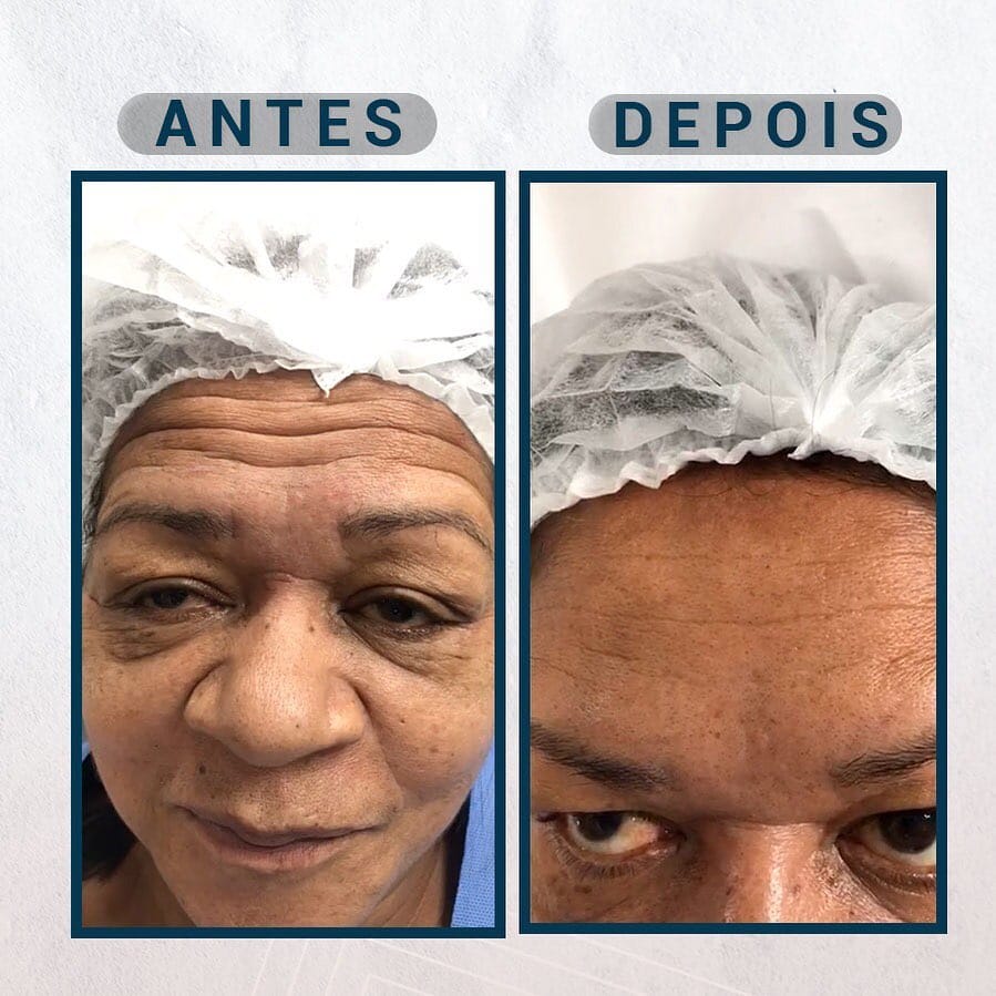 Post 7 by Dr.Estevão Fabricio on Instagram (image)