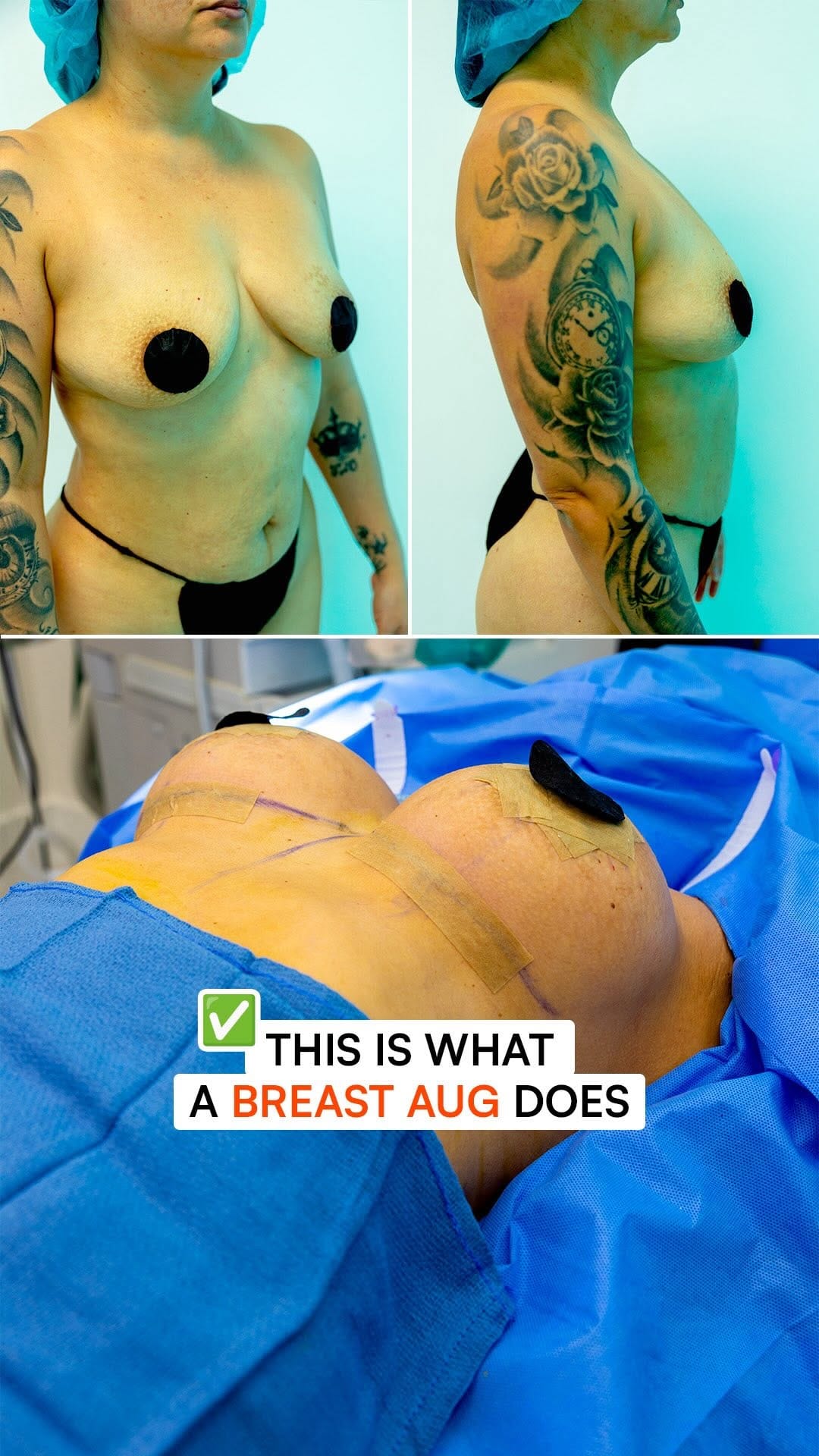 Post 4 by New Life Plastic Surgery Miami on Instagram (video)