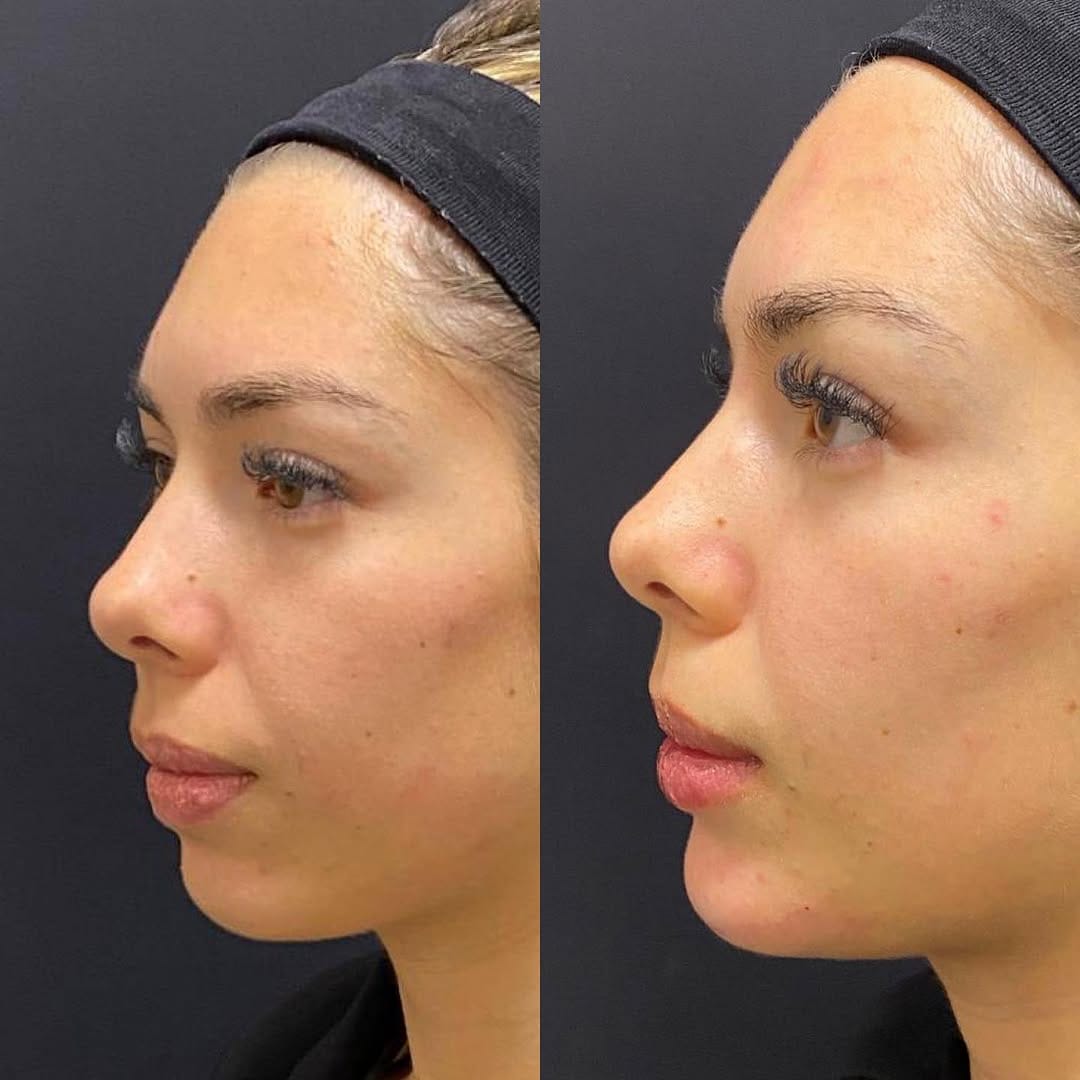 Post 8 by FISCHER ODONTOLOGIA EPAO 1751 on Instagram (image)