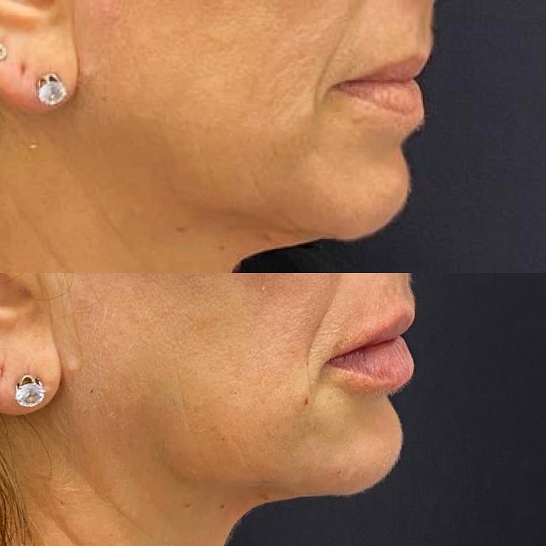 Post 7 by FISCHER ODONTOLOGIA EPAO 1751 on Instagram (image)