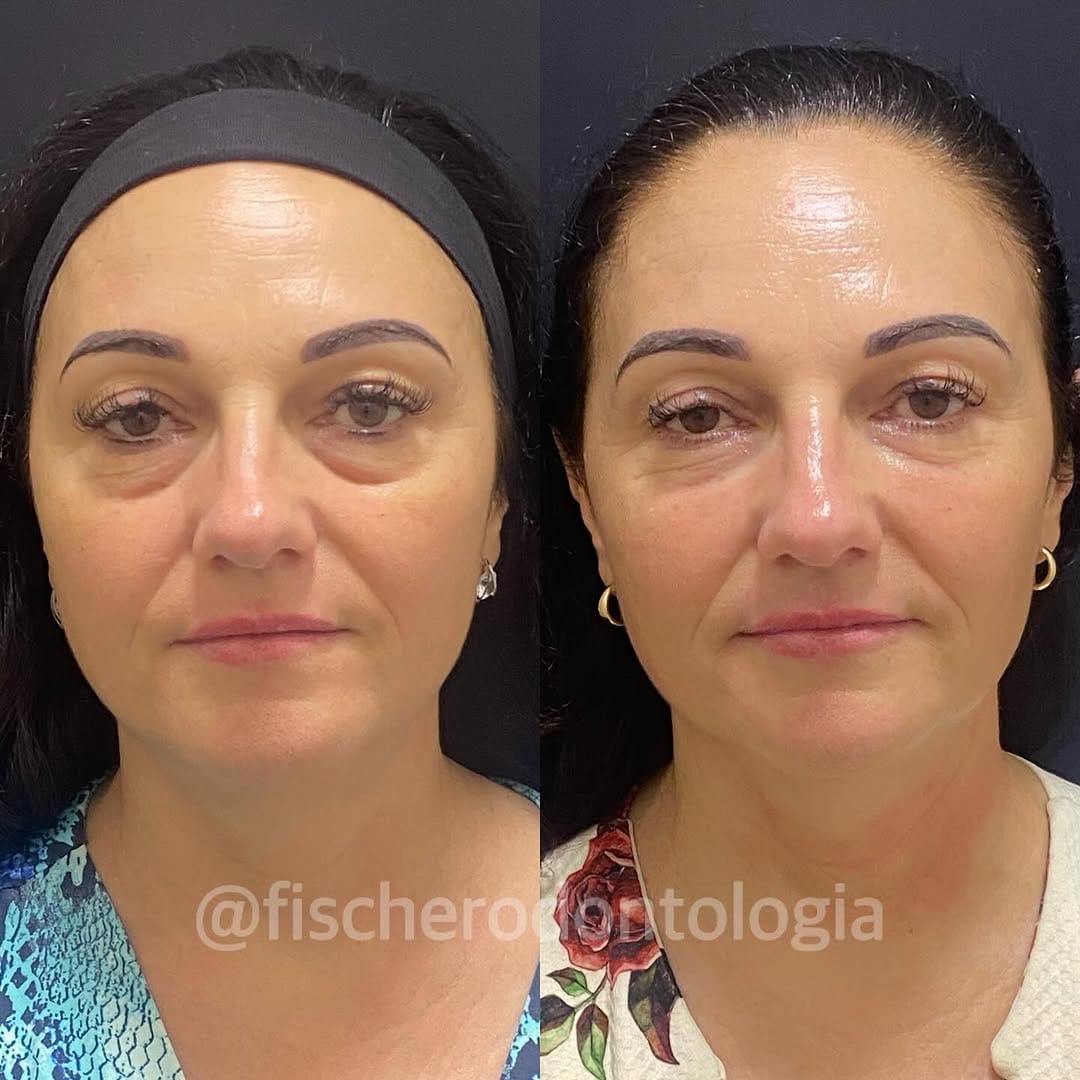 Post 3 by FISCHER ODONTOLOGIA EPAO 1751 on Instagram (carousel)