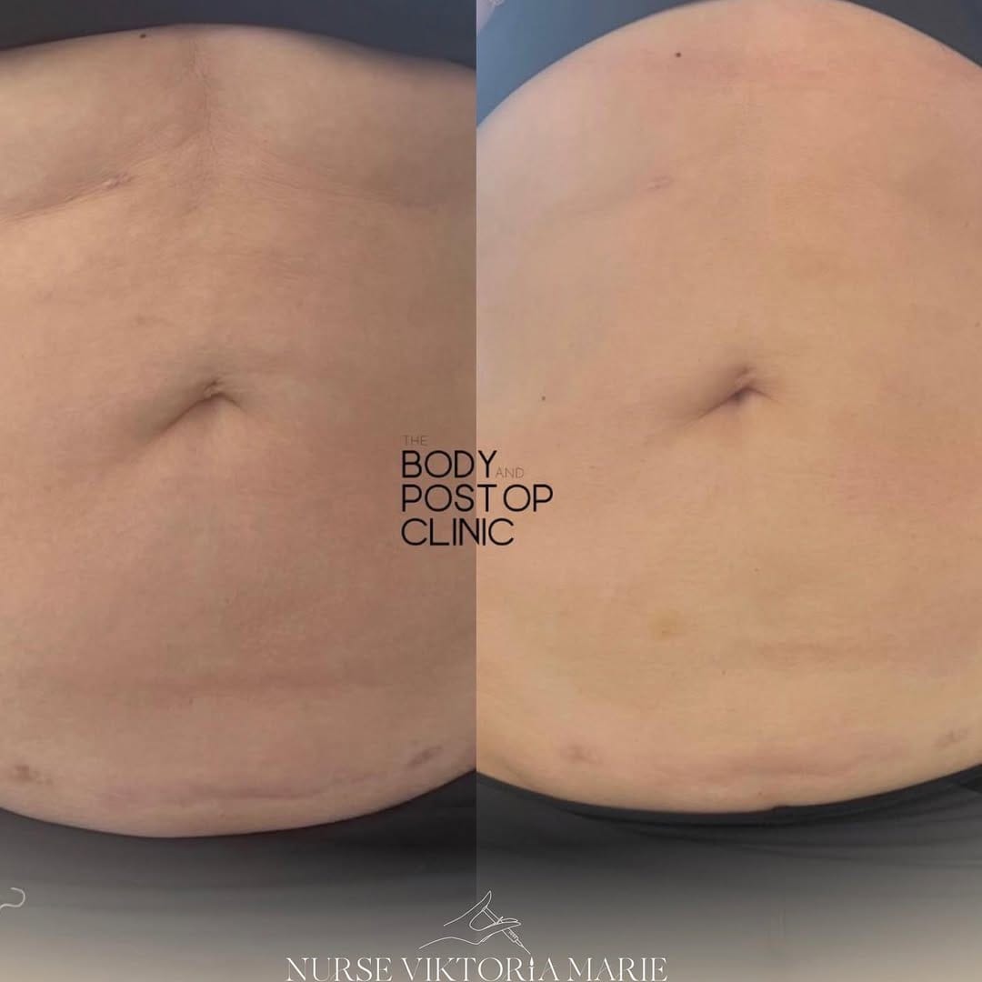 Post 9 by Nurse Viktoria Marie on Instagram (image)