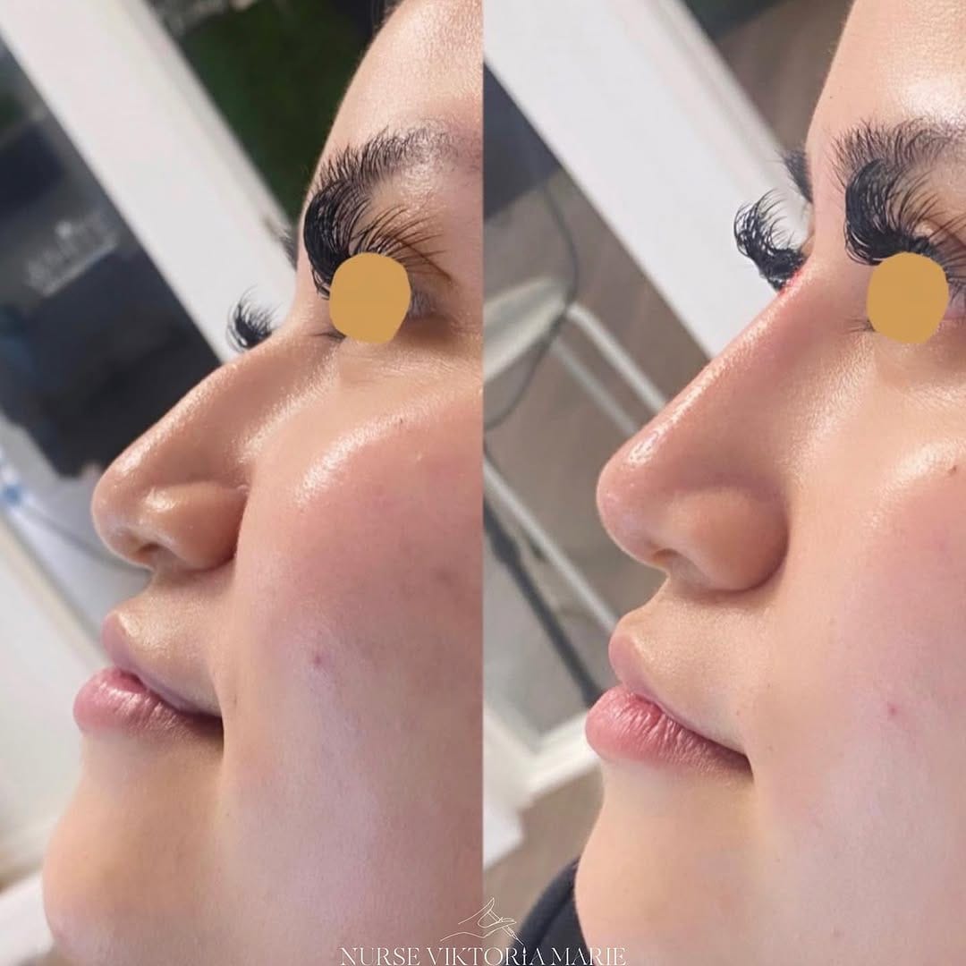 Post 8 by Nurse Viktoria Marie on Instagram (image)