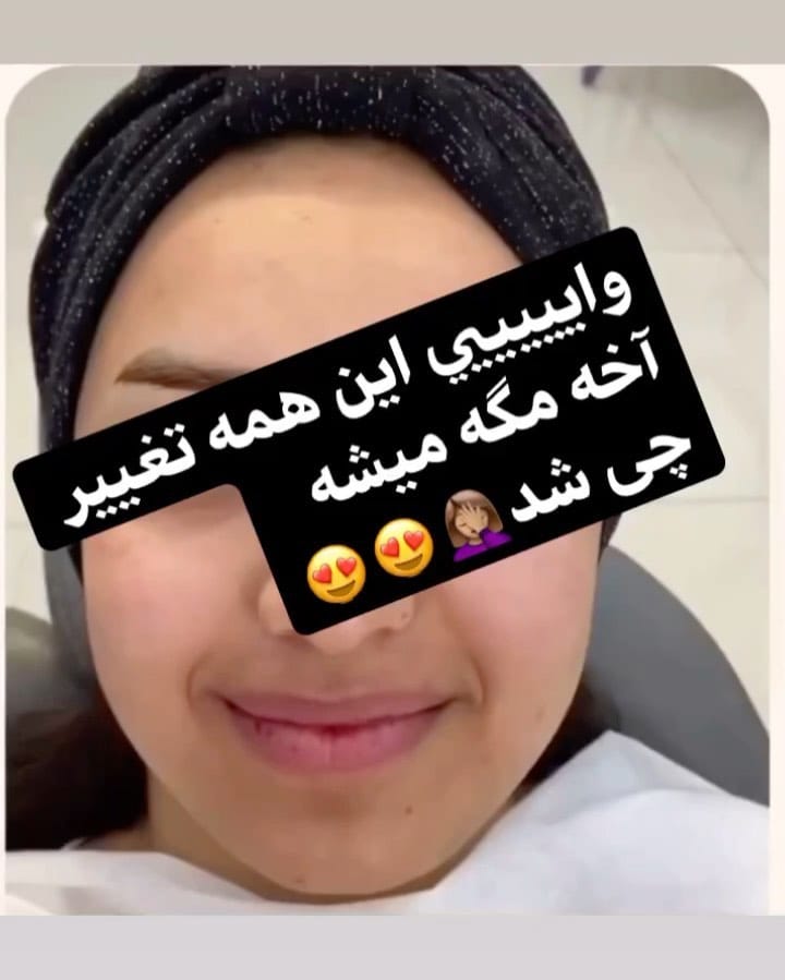 Post 6 by مدرک میکاپ از کانادا و گرجستان on Instagram (video)