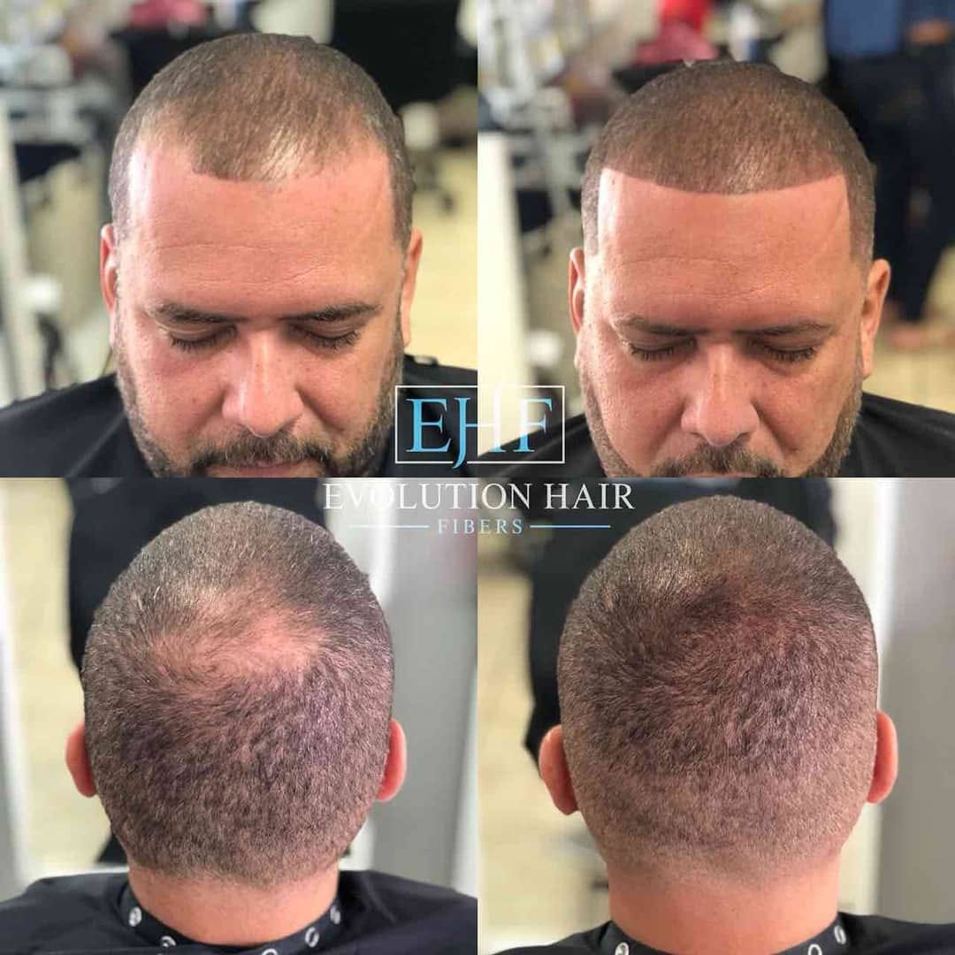 Post 1 by Evolution Hair Fibers on Instagram (image)