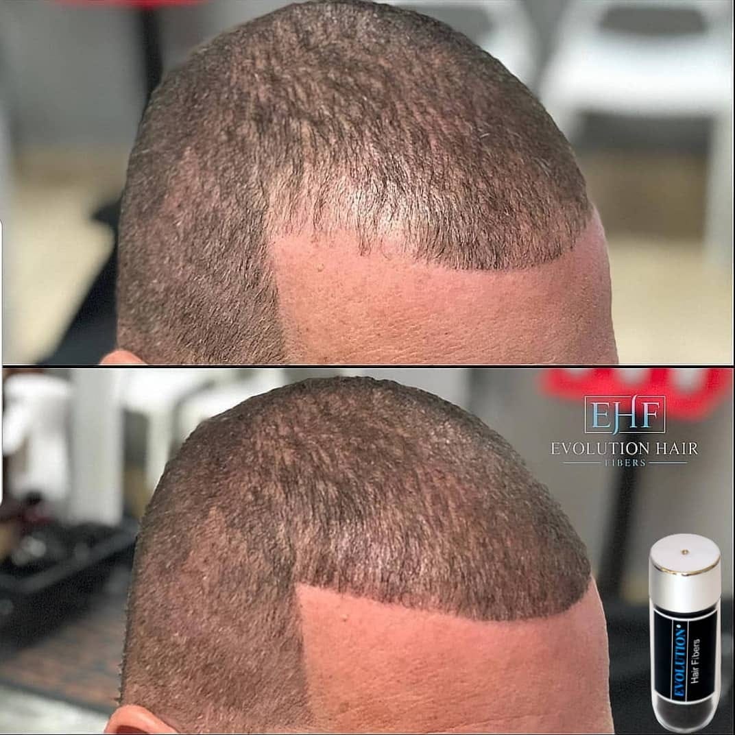 Post 7 by Evolution Hair Fibers on Instagram (image)