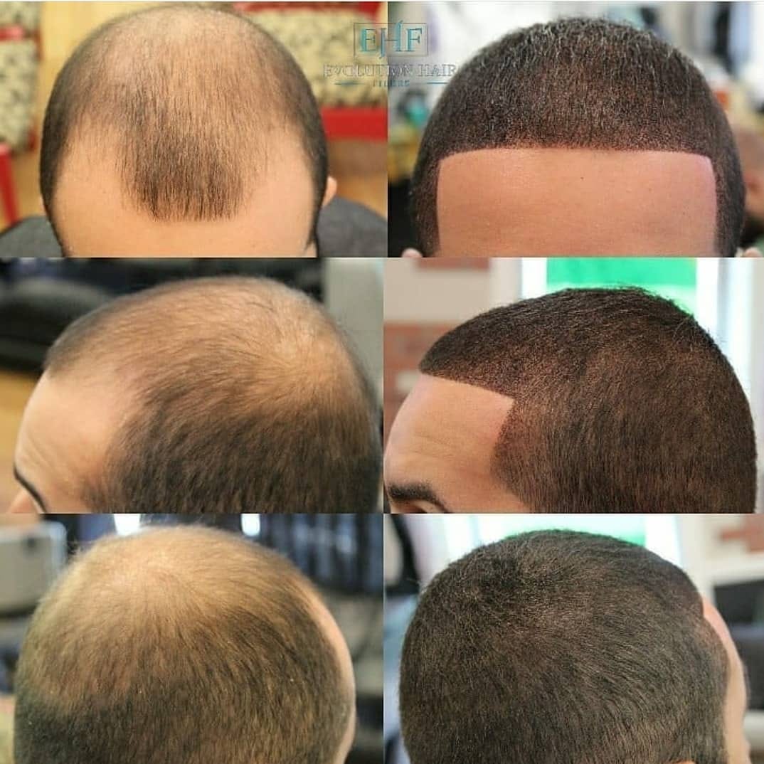 Post 3 by Evolution Hair Fibers on Instagram (image)