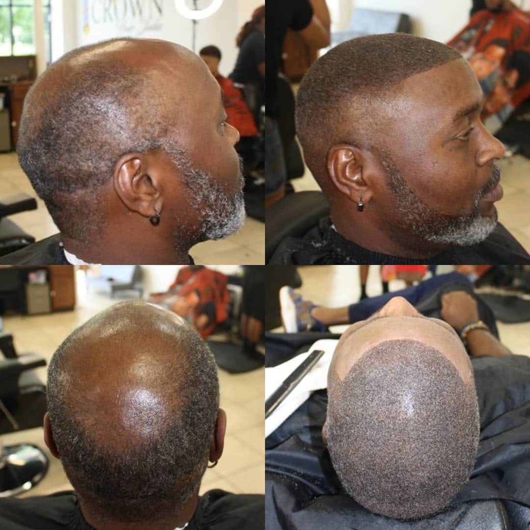 Post 5 by Evolution Hair Fibers on Instagram (image)