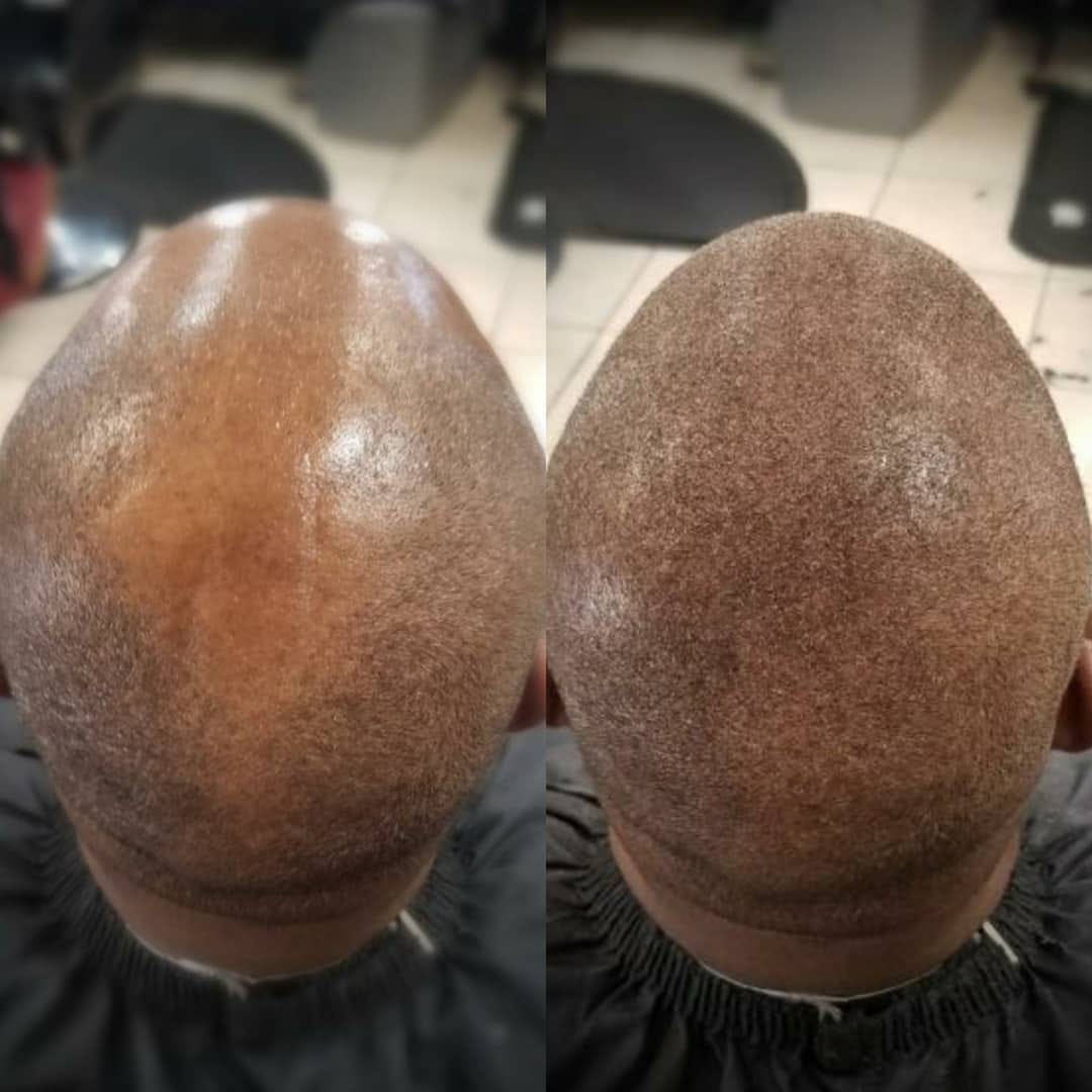 Post 2 by Evolution Hair Fibers on Instagram (image)