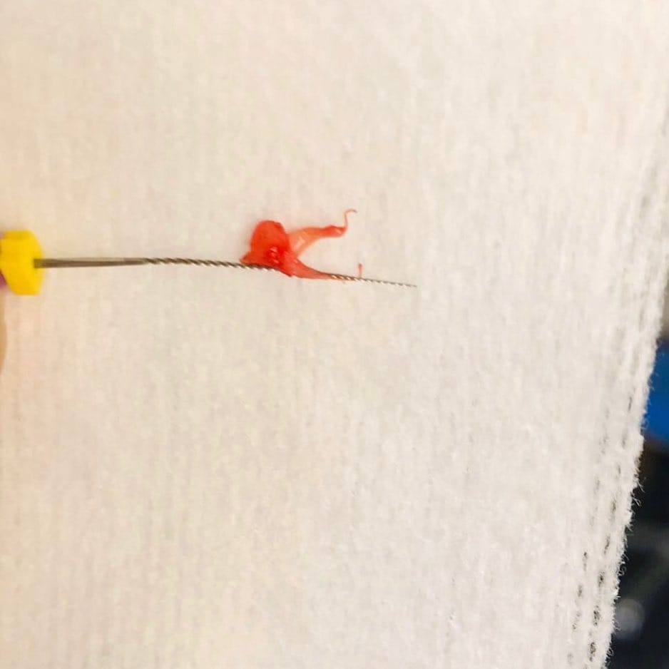 Post 5 by Dr.Bassam 💉💊 on Instagram (image)