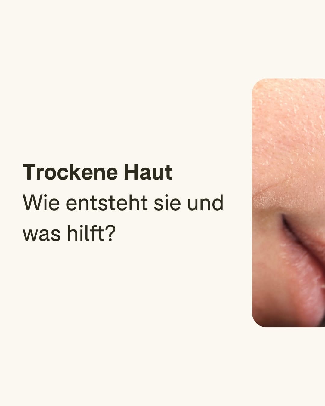Post 2 by Natürliche Anti-Aging Hautpflege on Instagram (carousel)