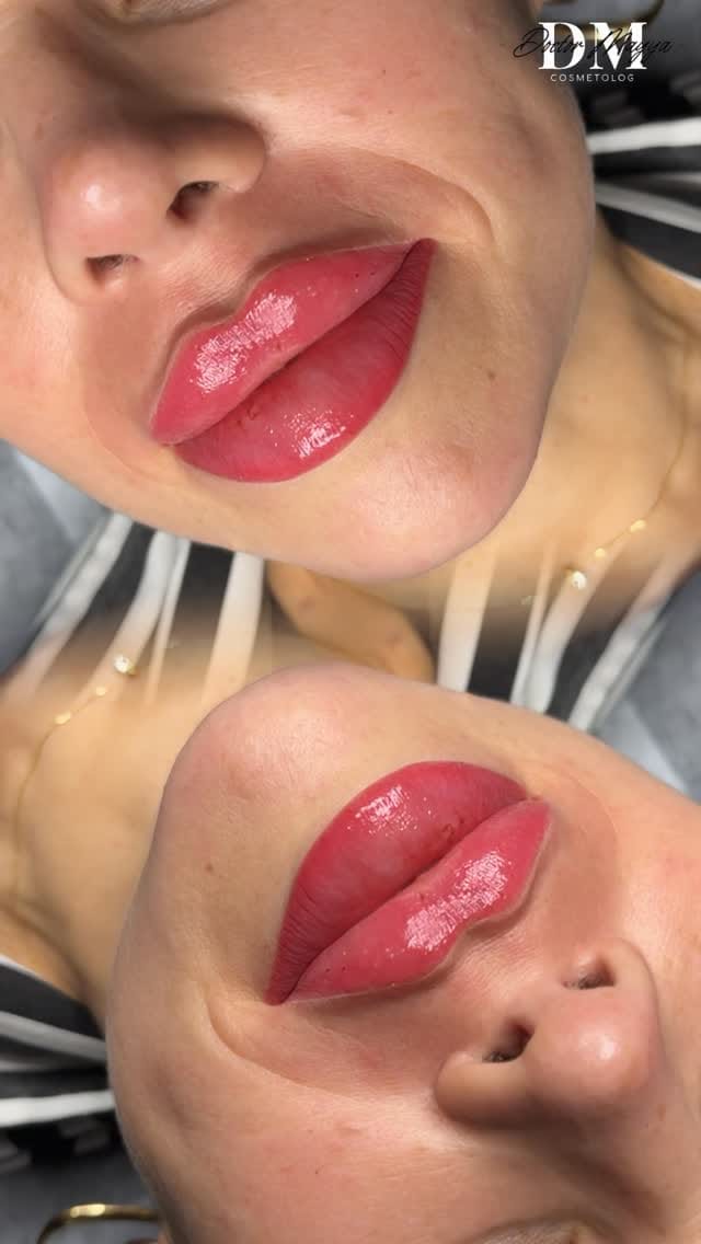 Post 1 by Косметолог | Губы | Ботокс  | Обучение | Краснодар l Dubai on Instagram (video)