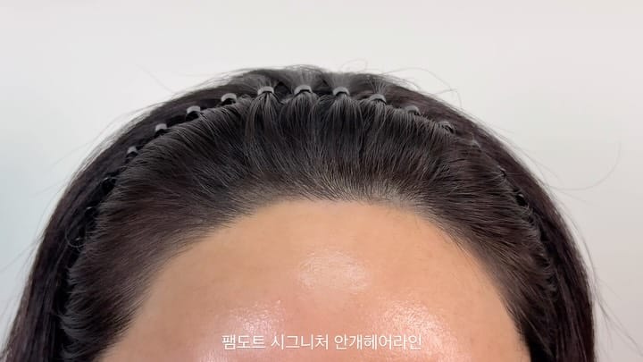 Post 7 by 광주두피문신/안개헤어라인/smp교육 on Instagram (carousel)