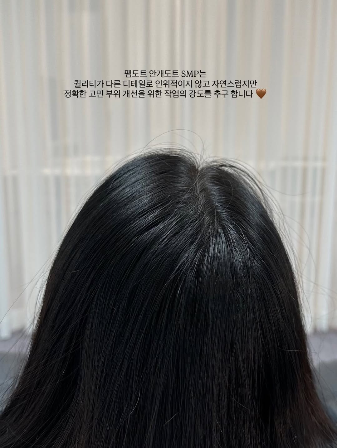 Post 1 by 광주두피문신/안개헤어라인/smp교육 on Instagram (carousel)