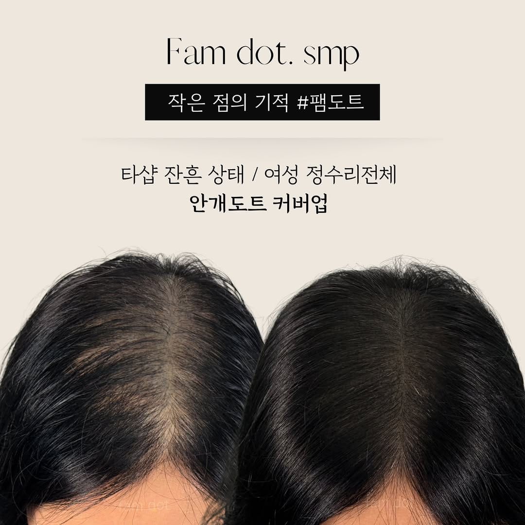 Post 5 by 광주두피문신/안개헤어라인/smp교육 on Instagram (carousel)