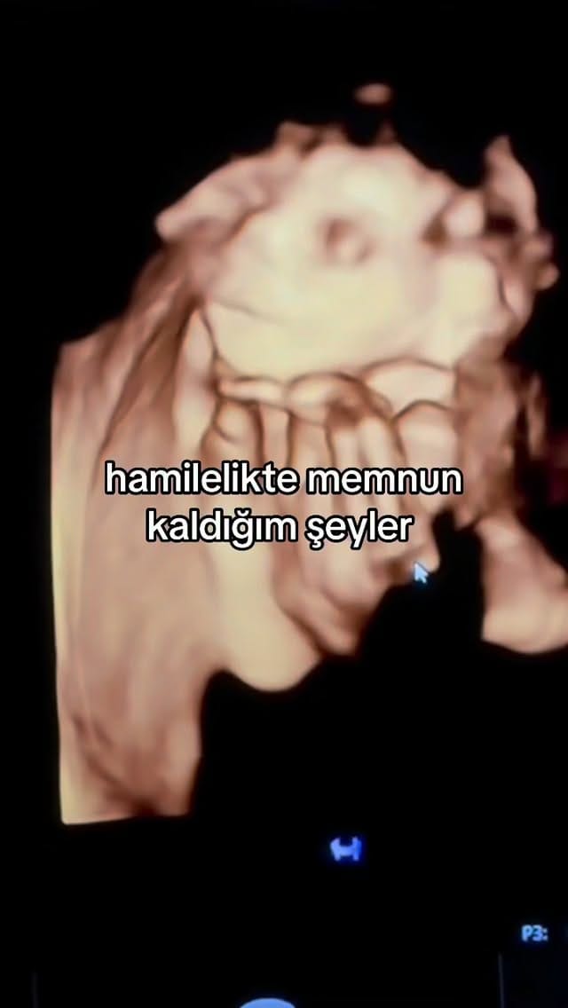 Post 9 by Ceren Tabak on Instagram (video)