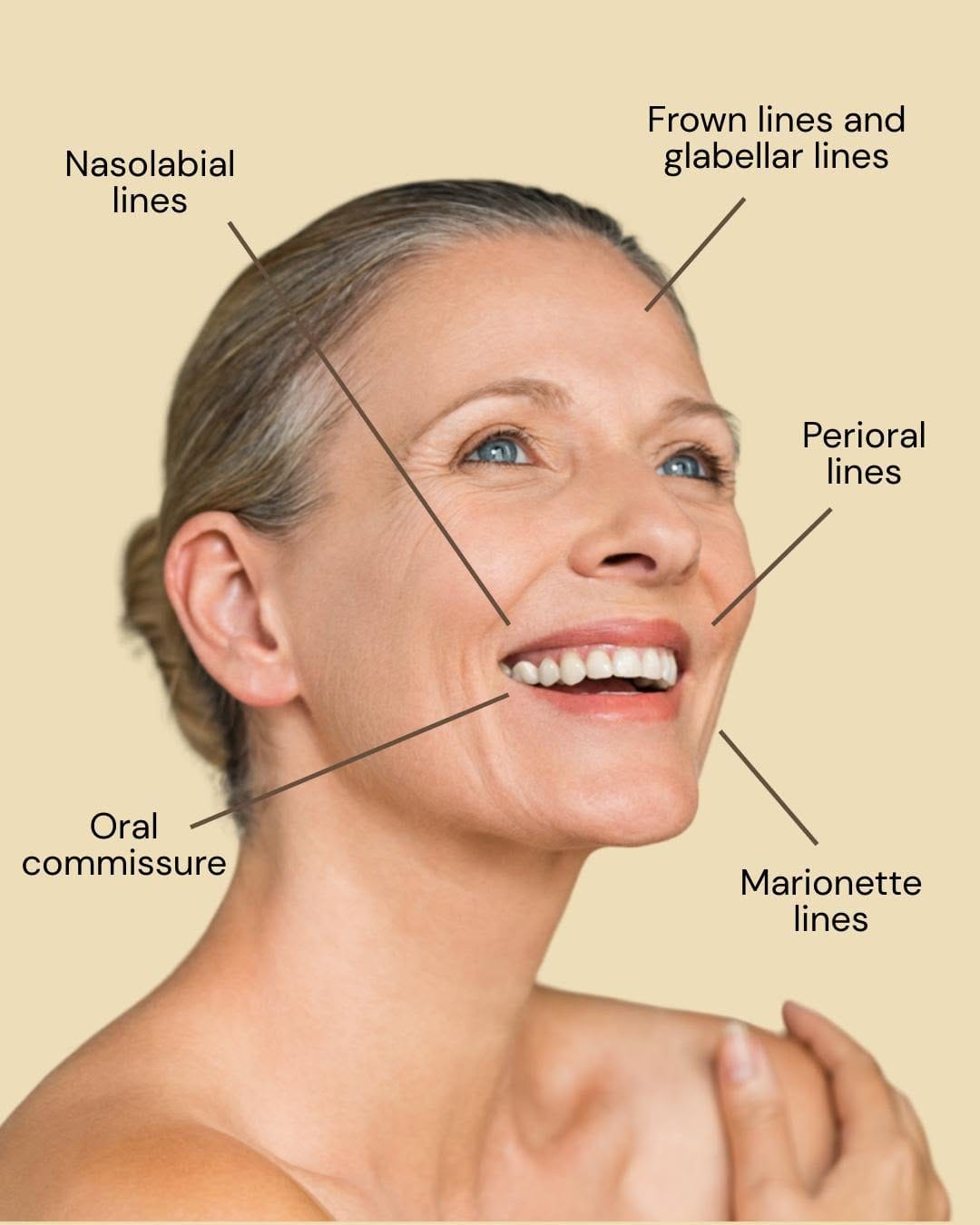 Post 4 by Dr. Leah Skin Clinics London | Most Trusted UK Clinic 2023 on Instagram (image)