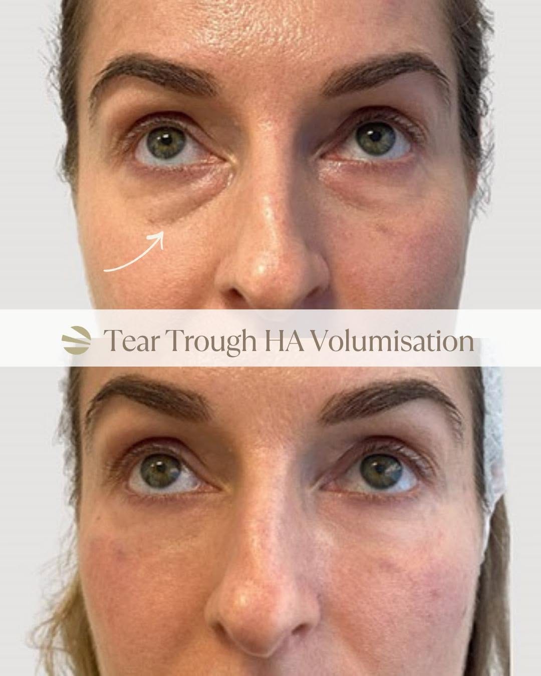 Post 3 by Dr. Leah Skin Clinics London | Most Trusted UK Clinic 2023 on Instagram (image)