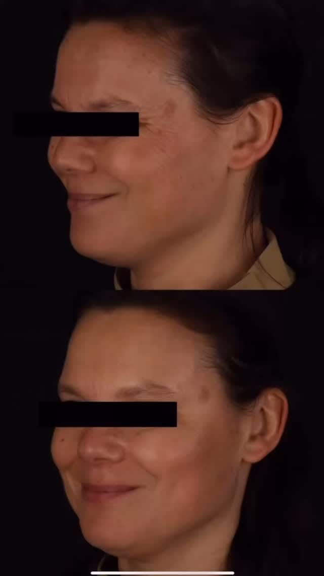 Post 7 by Leonor Quesada | Médica Dentista on Instagram (video)