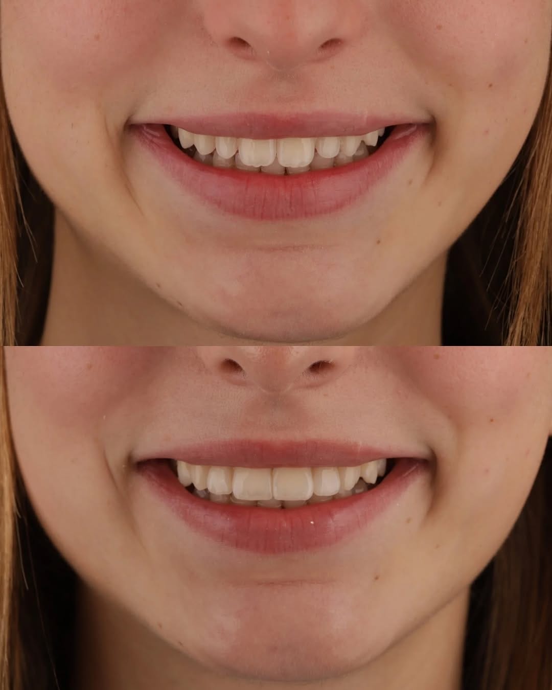 Post 4 by Leonor Quesada | Médica Dentista on Instagram (image)