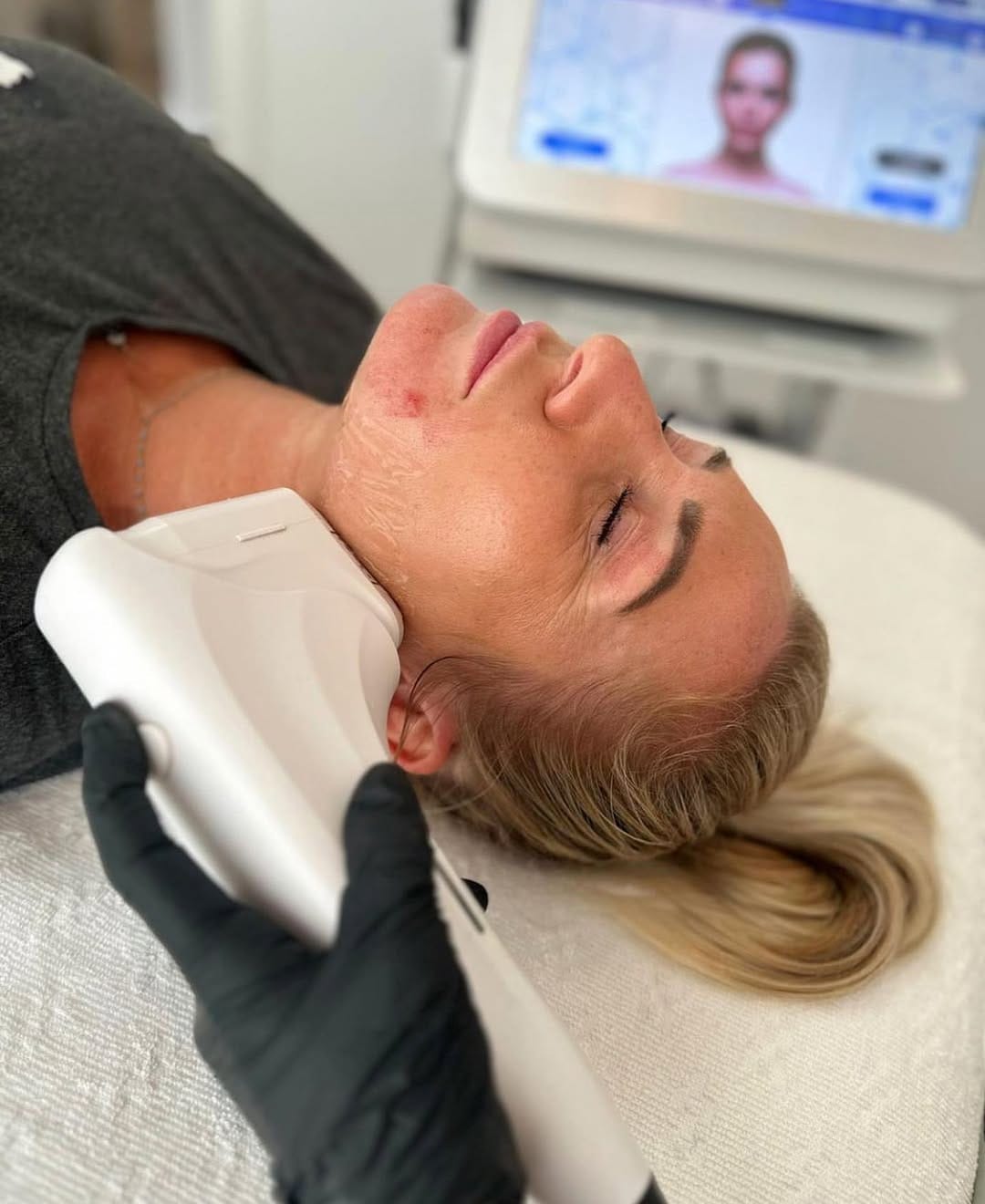 Post 6 by Lavish Body Clinic Marbella 🇪🇸 on Instagram (image)
