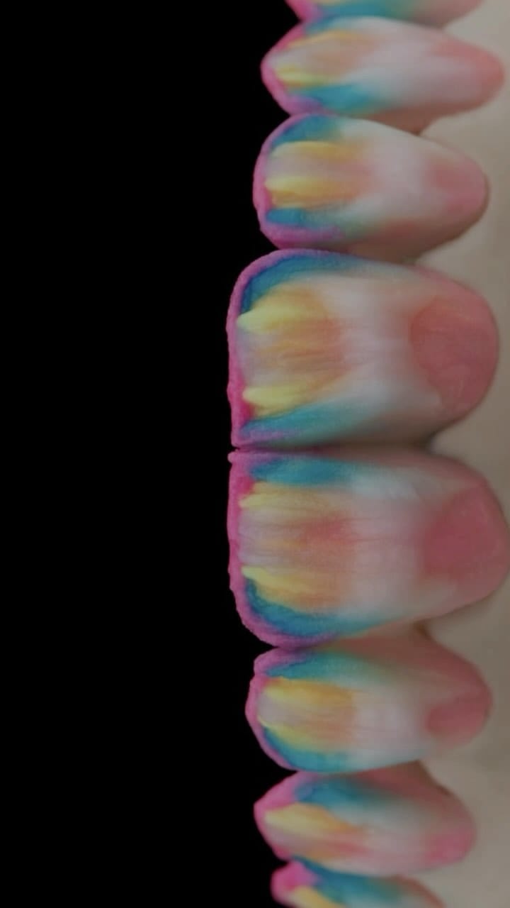 Post 9 by Dr.Wael Alkaabi  🇮🇶🦷 د.وائل الكعبي on Instagram (video)