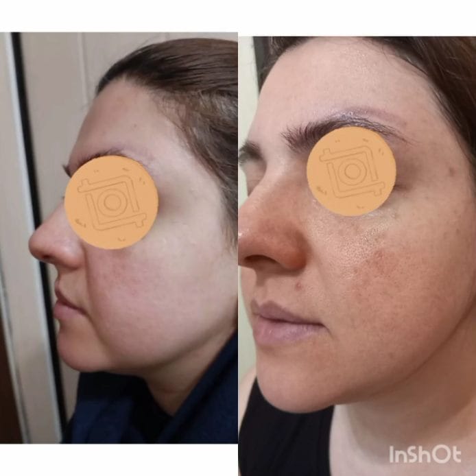 Post 8 by Golara.Golestani.Skincare on Instagram (video)