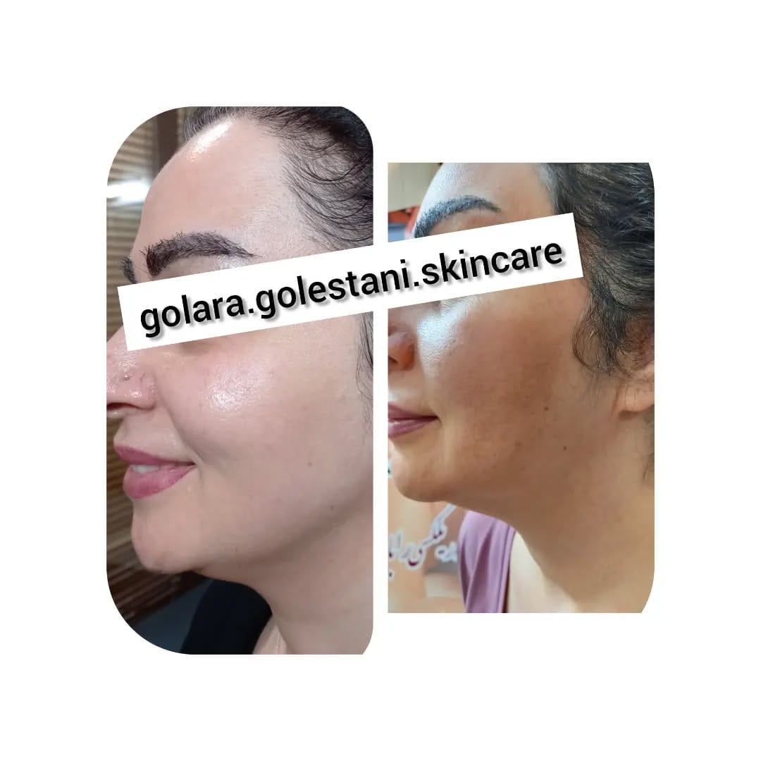 Post 5 by Golara.Golestani.Skincare on Instagram (image)