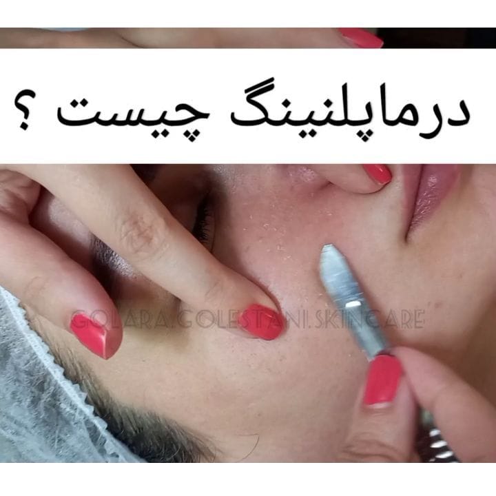 Post 9 by Golara.Golestani.Skincare on Instagram (video)