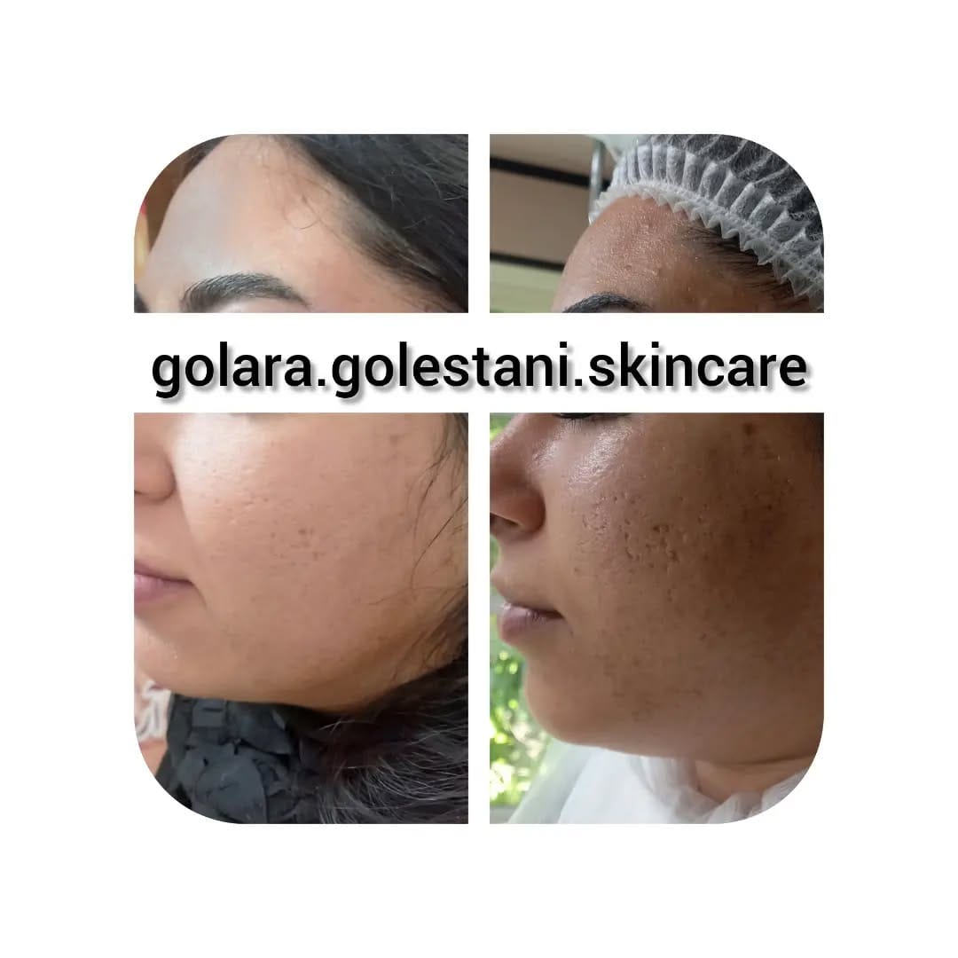 Post 4 by Golara.Golestani.Skincare on Instagram (image)