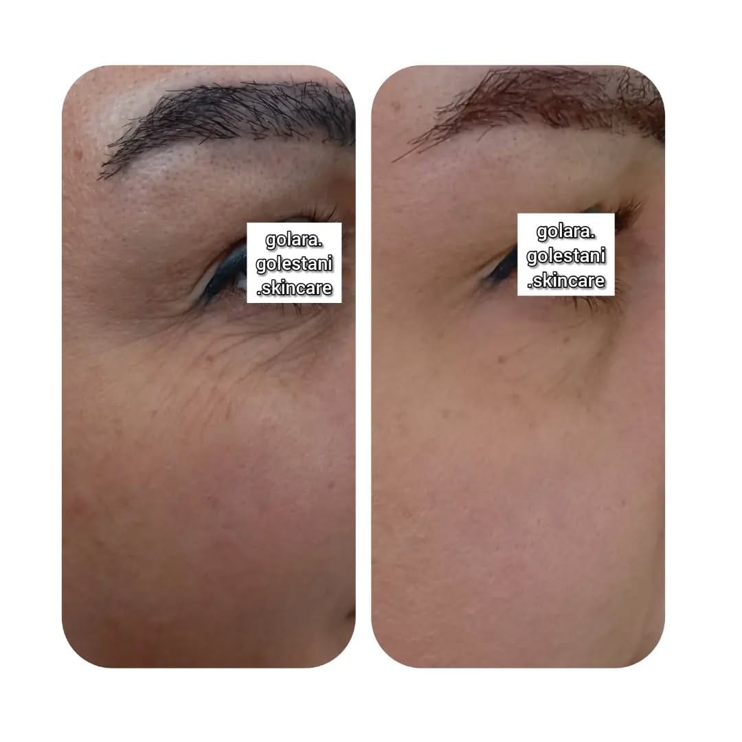 Post 2 by Golara.Golestani.Skincare on Instagram (image)