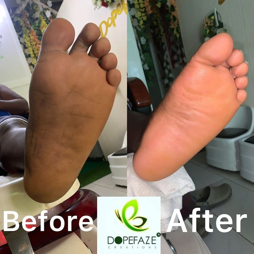 Post 9 by BEST SKINCARE AND SPA IN LAGOS on Instagram (image)