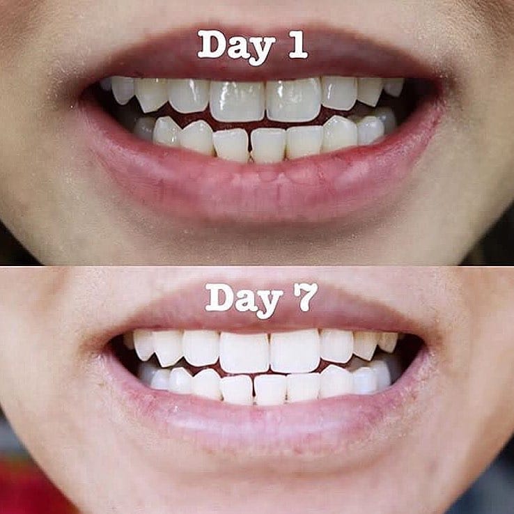 Post 5 by Ecaya Paris Fans on Instagram (image)