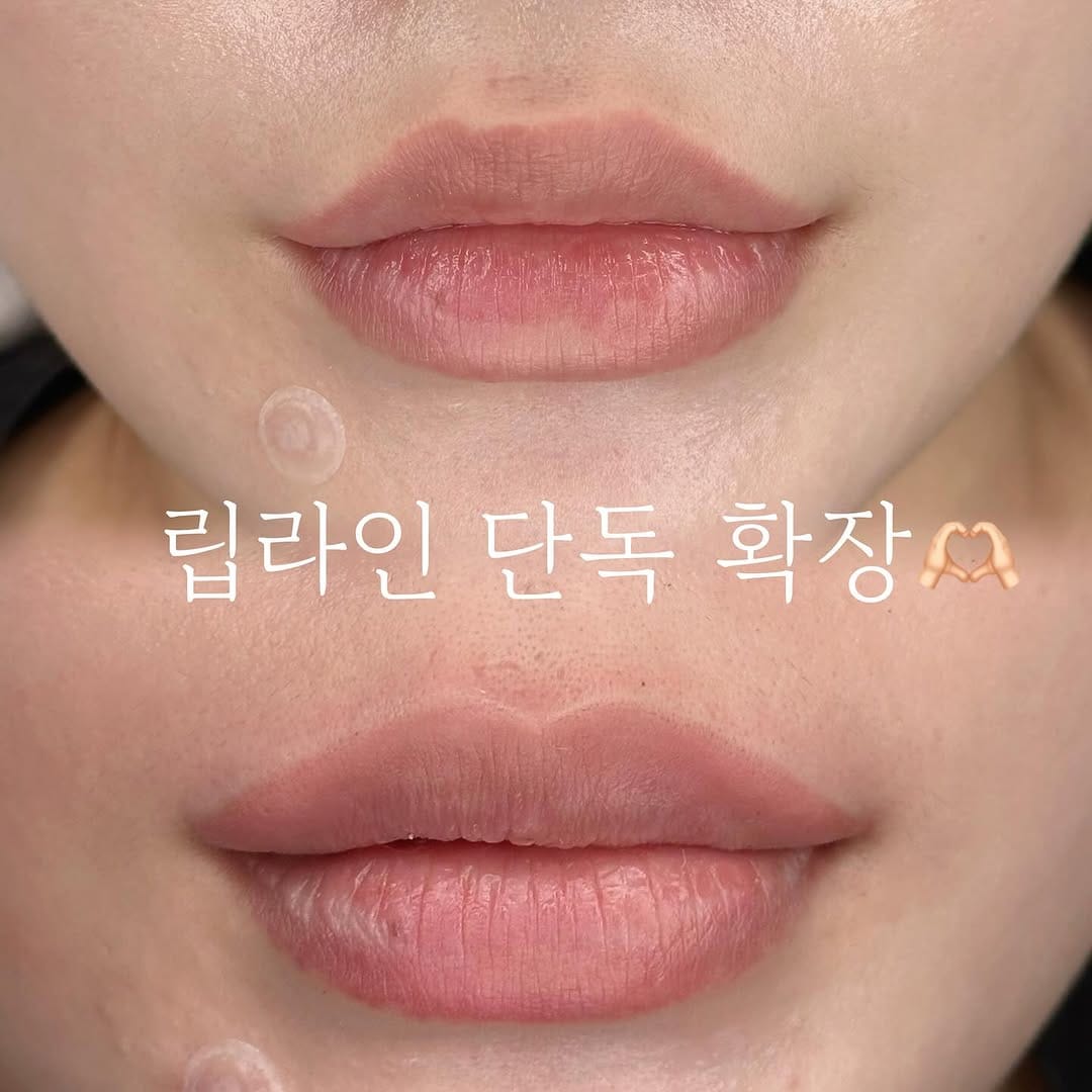 Post 8 by #부산오버립반영구 #부산다크서클반영구 최초 더스케치 on Instagram (image)