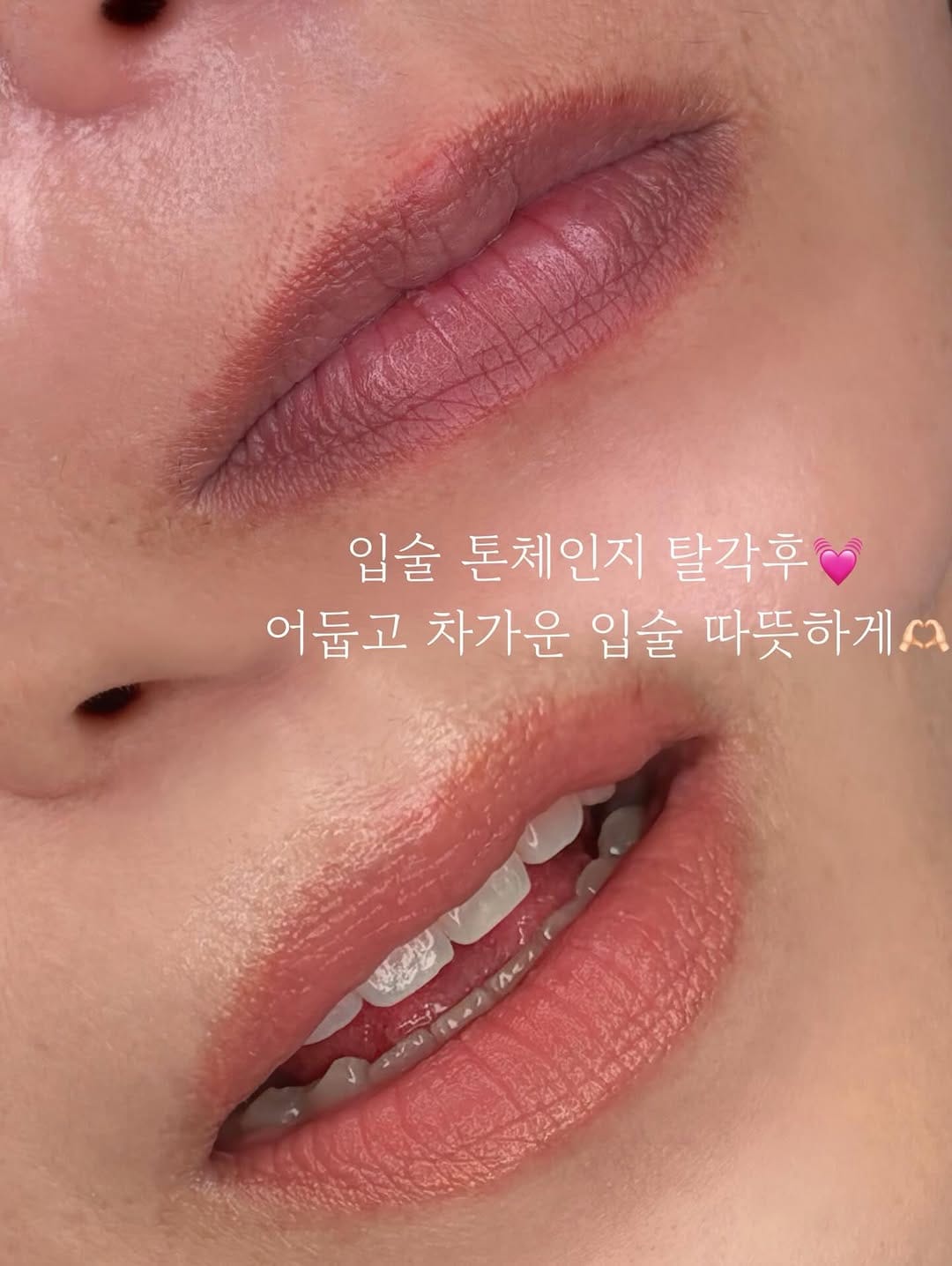 Post 7 by #부산오버립반영구 #부산다크서클반영구 최초 더스케치 on Instagram (image)