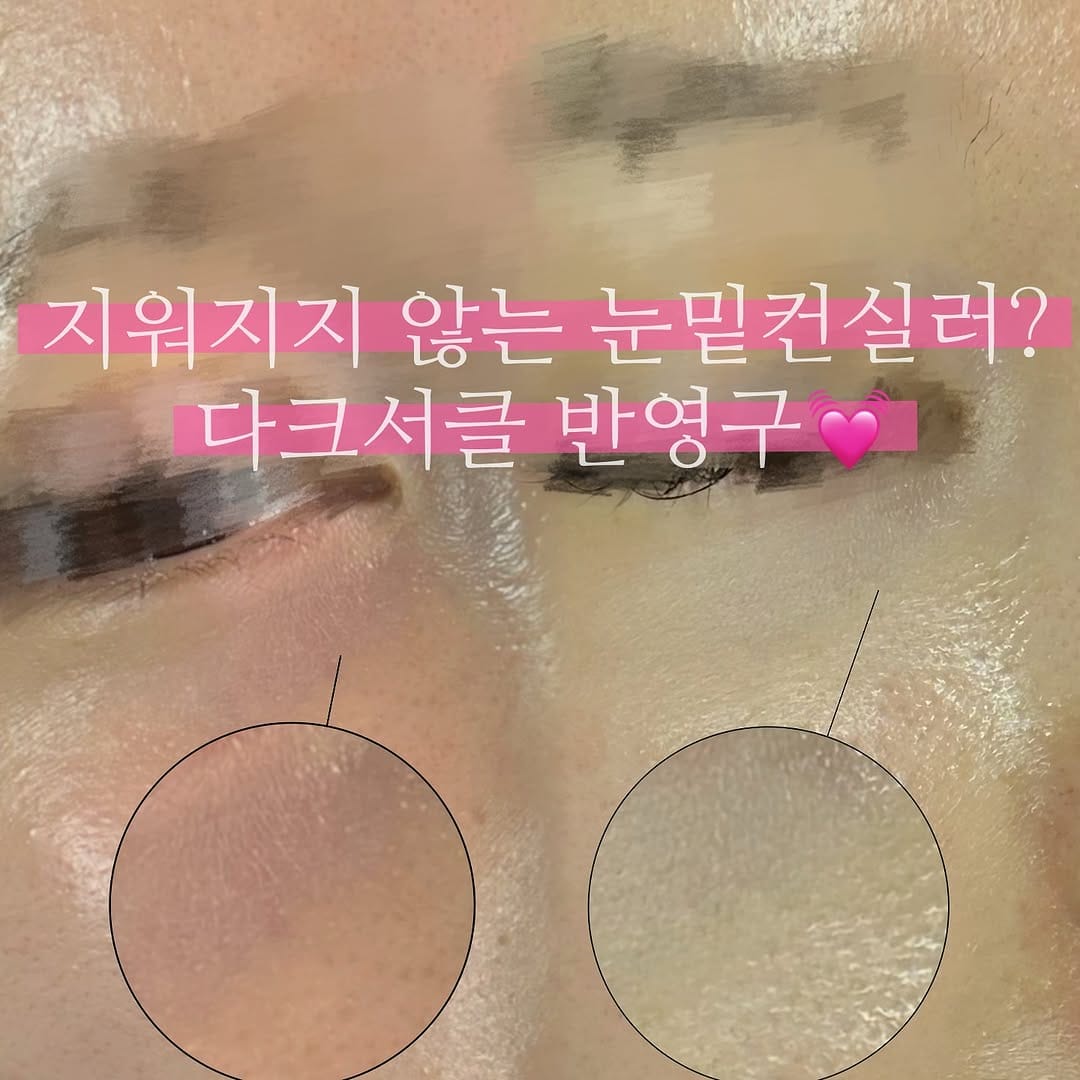 Post 9 by #부산오버립반영구 #부산다크서클반영구 최초 더스케치 on Instagram (image)