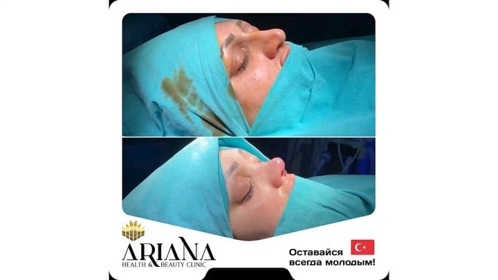 Post 6 by Novin irana clinic on Instagram (video)