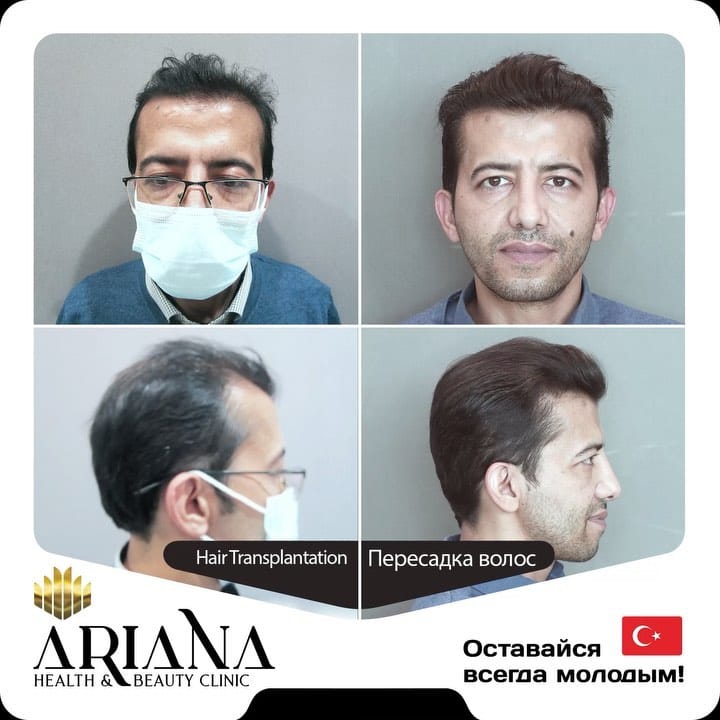 Post 3 by Novin irana clinic on Instagram (video)