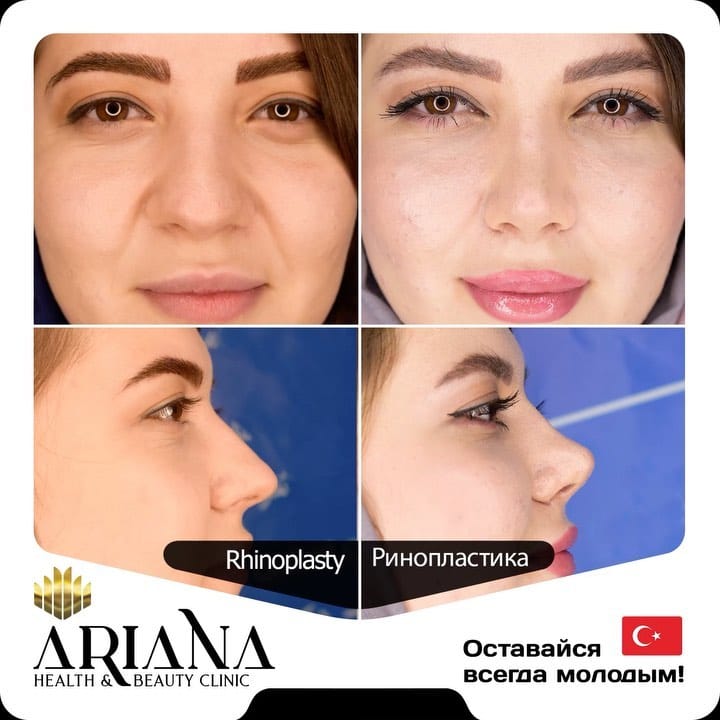 Post 9 by Novin irana clinic on Instagram (video)