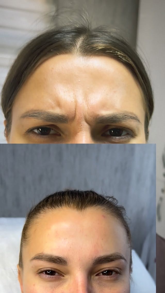 Post 8 by КОСМЕТОЛОГ АНКАРА-КИЕВ💉👄 on Instagram (video)