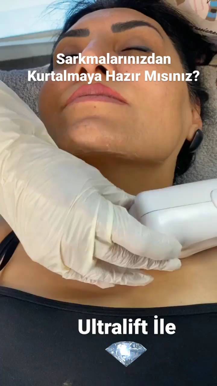 Post 3 by Özlem 💎 Karmen VIP Estetik on Instagram (video)