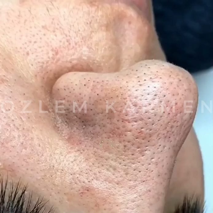 Post 9 by Özlem 💎 Karmen VIP Estetik on Instagram (video)