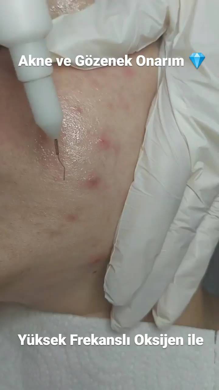 Post 5 by Özlem 💎 Karmen VIP Estetik on Instagram (video)