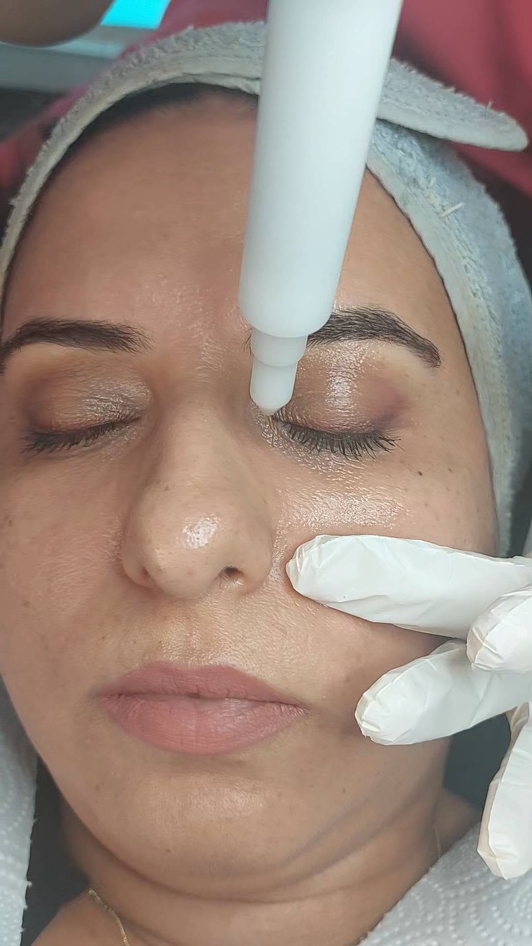 Post 1 by Özlem 💎 Karmen VIP Estetik on Instagram (video)