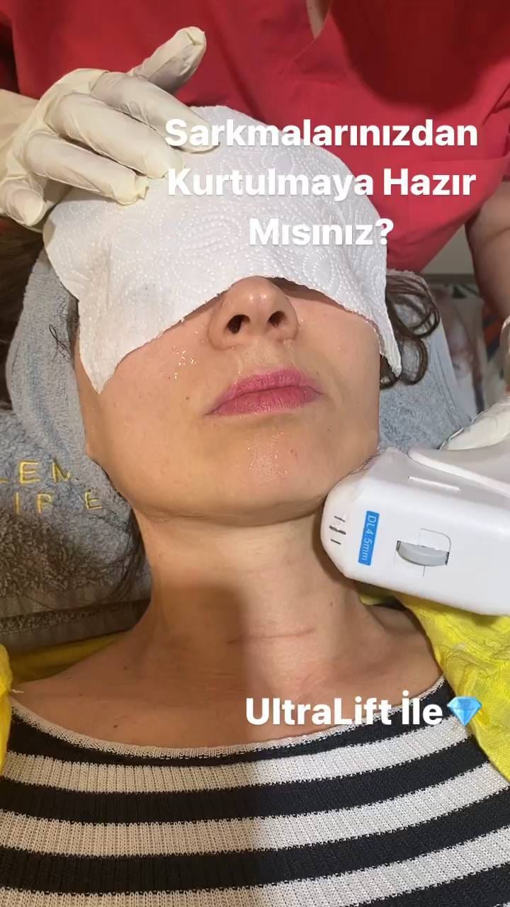 Post 4 by Özlem 💎 Karmen VIP Estetik on Instagram (video)